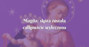 magda: skóra została całkowicie wyleczona